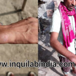 बिहपुर के सोनवर्षा में दिव्यांग के साथ अभद्रता ओर मारपीट ।। Inquilabindia