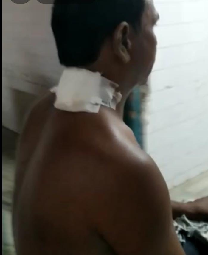 पूर्व के जमीनी विवाद में शौच के दौरान पड़ोसी ने किसान को मारी गोली ।। 2 img 20220402 wa00522954890204013436480