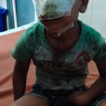 Inq Tmp 33 मिलकी में कुत्तों का कहर: खेल रहे मासूम पर झुंड ने बोला हमला, नोंच ली नाक