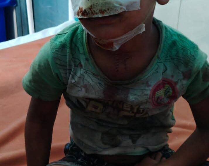 Inq Tmp 19 मिलकी में कुत्तों का कहर: खेल…