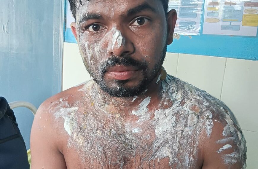 Inq Tmp 11 कटिहार जा रहे छात्र पर उबलती…